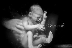 -Underwater Scream- Foto de Caroline Devulder 'Birth Photos of 2018'